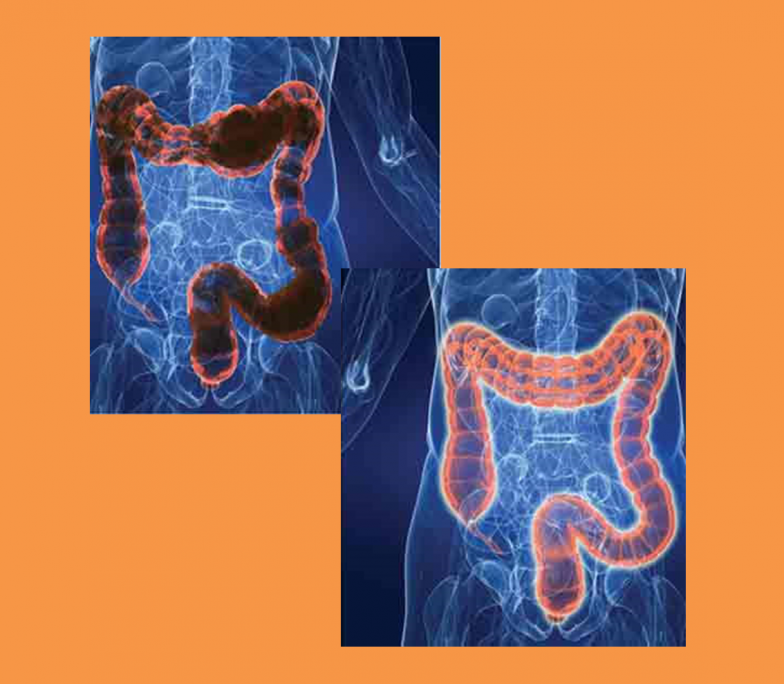 about-us-colon-health-centre-colonic-hydrotherapy-irrigation